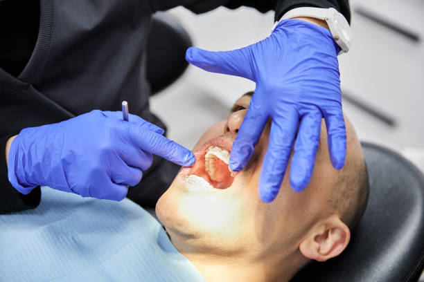 Best Emergency Dental Care for Broken or Chipped Teeth in New Hope, OR